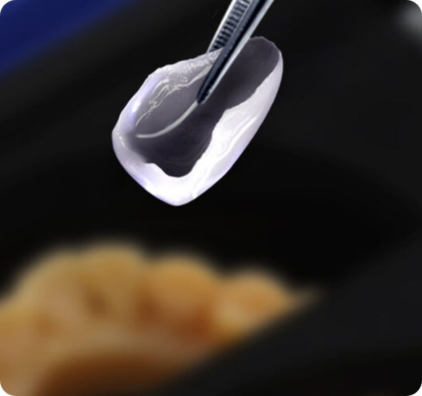 ピンセットでつままれた歯の模型に液体が付着している様子で、精密な歯科技工処理の工程を示すクローズアップ