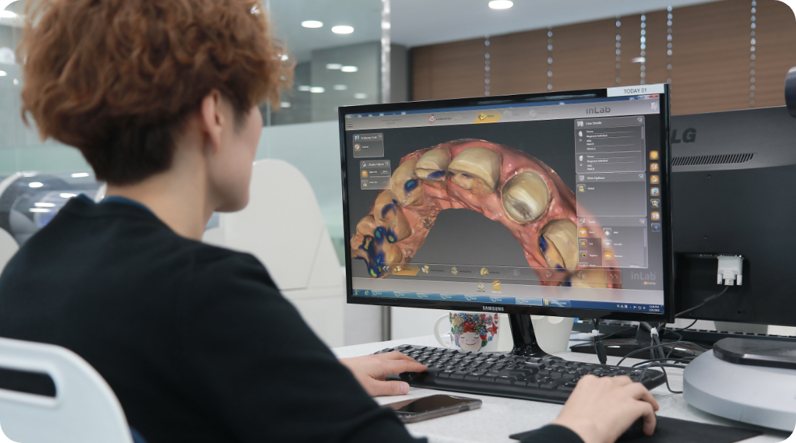 歯科用CADソフトで歯列の3Dデータを確認しながら設計作業を行う技工士の様子を捉えたデジタル技工の作業風景