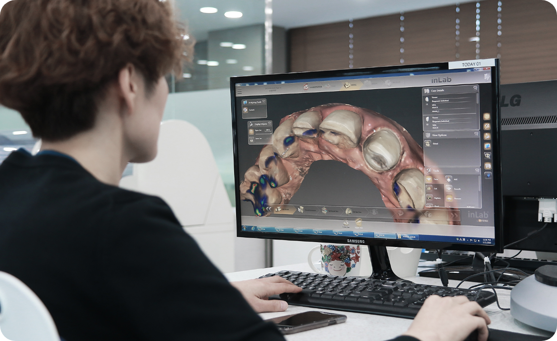 人物がパソコン画面で歯の3Dスキャンデータを確認し、歯科用ソフトで設計作業を行っている場面
